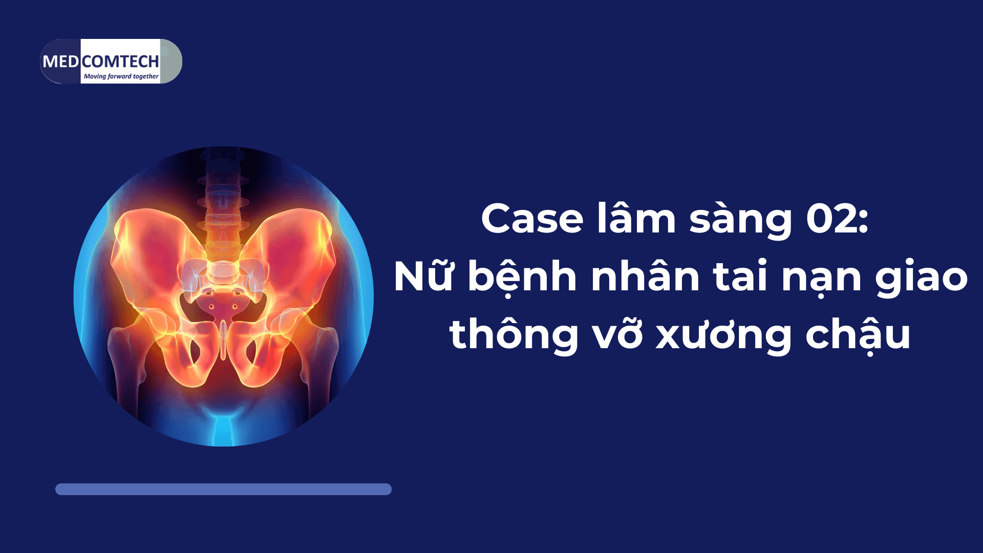 Case lâm sàng 02: Nữ bệnh nhân tai nạn giao thông vỡ xương chậu