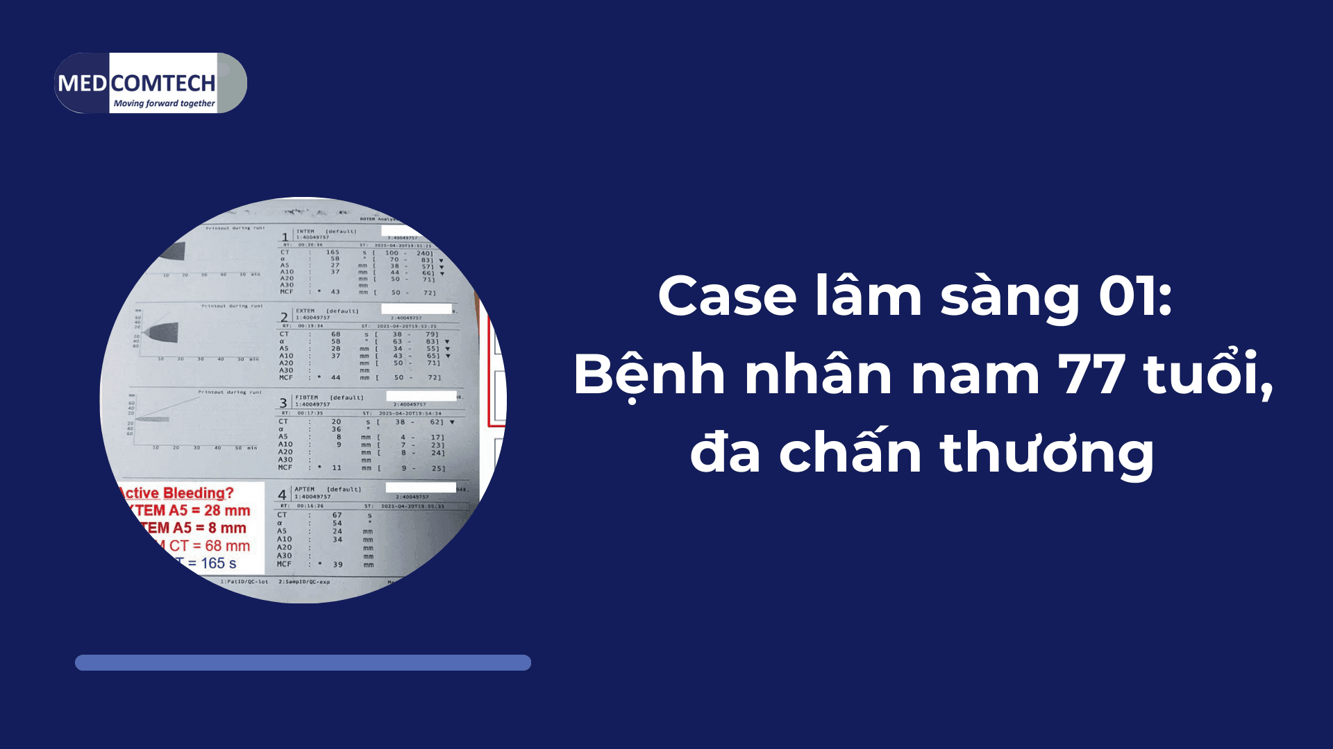 Case lâm sàng 01: Bệnh nhân nam 77 tuổi, đa chấn thương