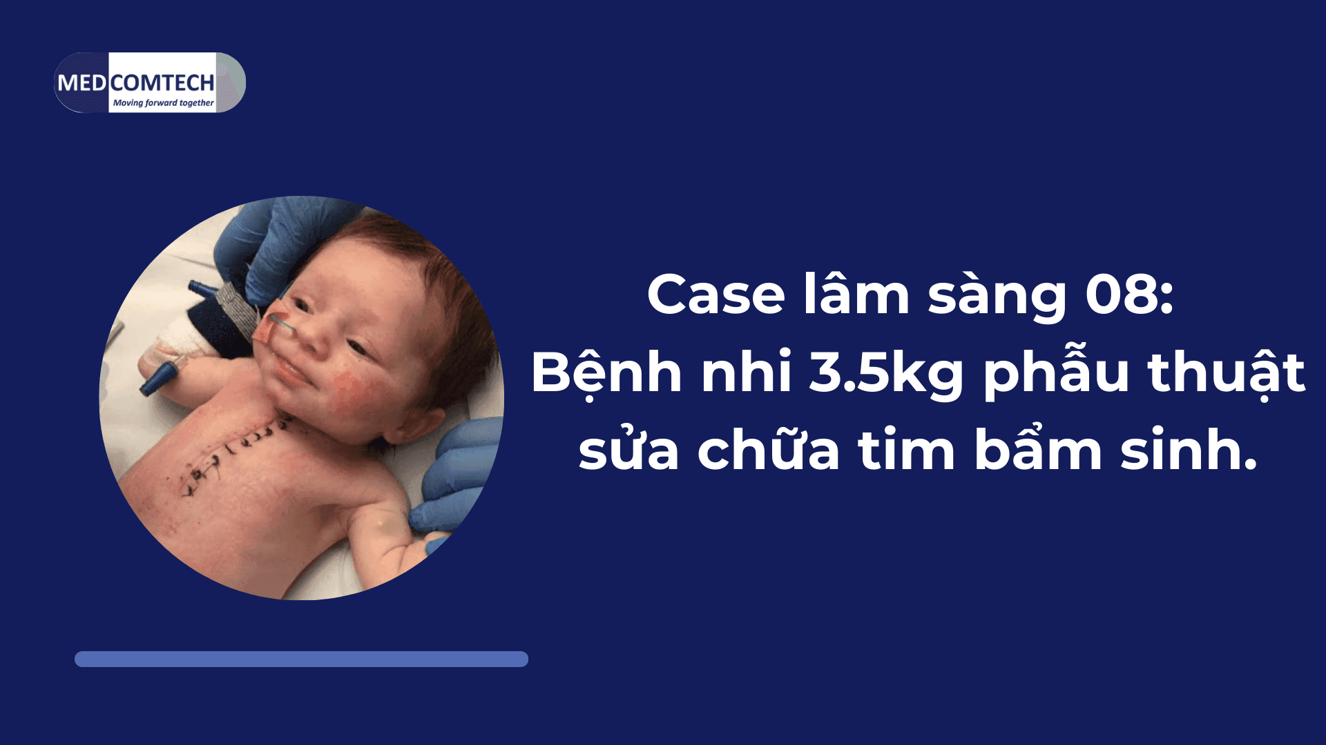 Case lâm sàng 08: Bệnh nhi 3.5kg phẫu thuật sửa chữa tim bẩm sinh.