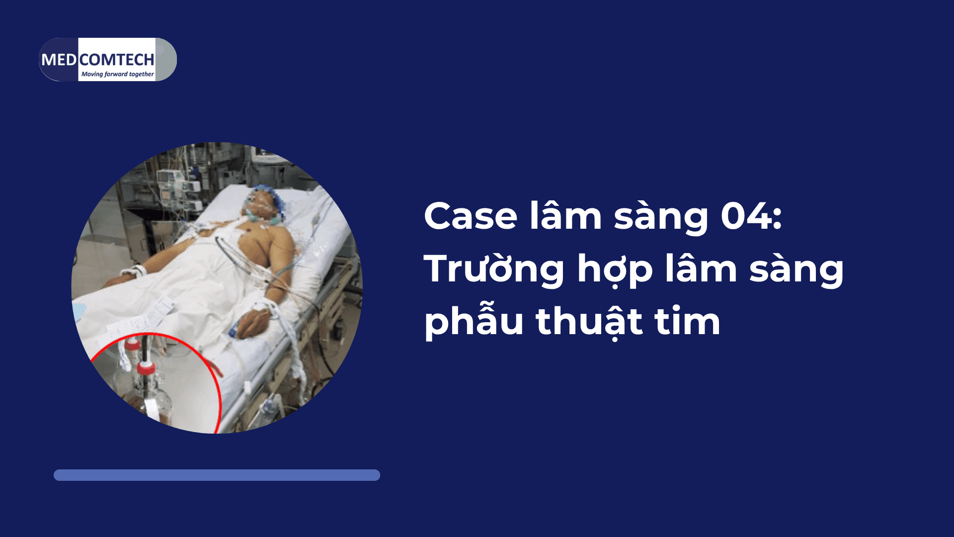 Case lâm sàng 04: Trường hợp lâm sàng phẫu thuật tim