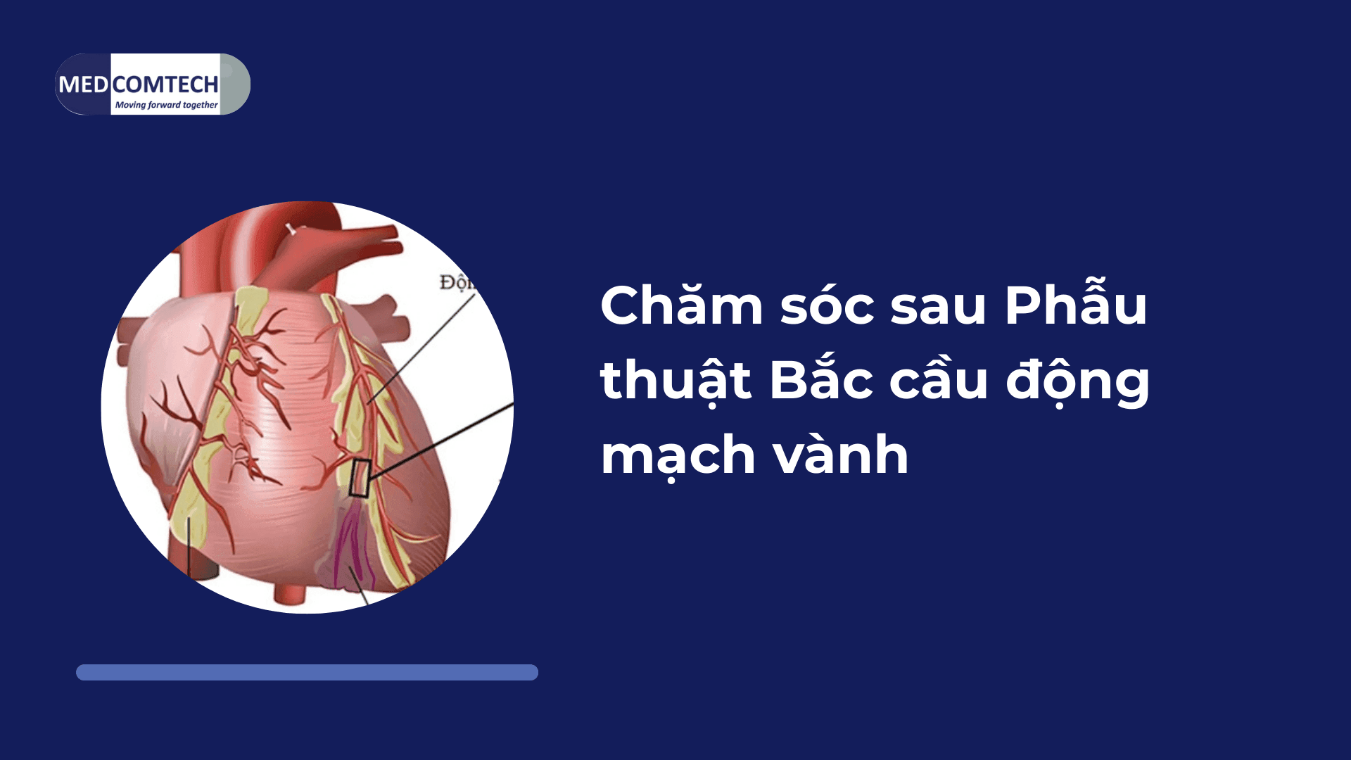 Chăm sóc sau Phẫu thuật Bắc cầu động mạch vành