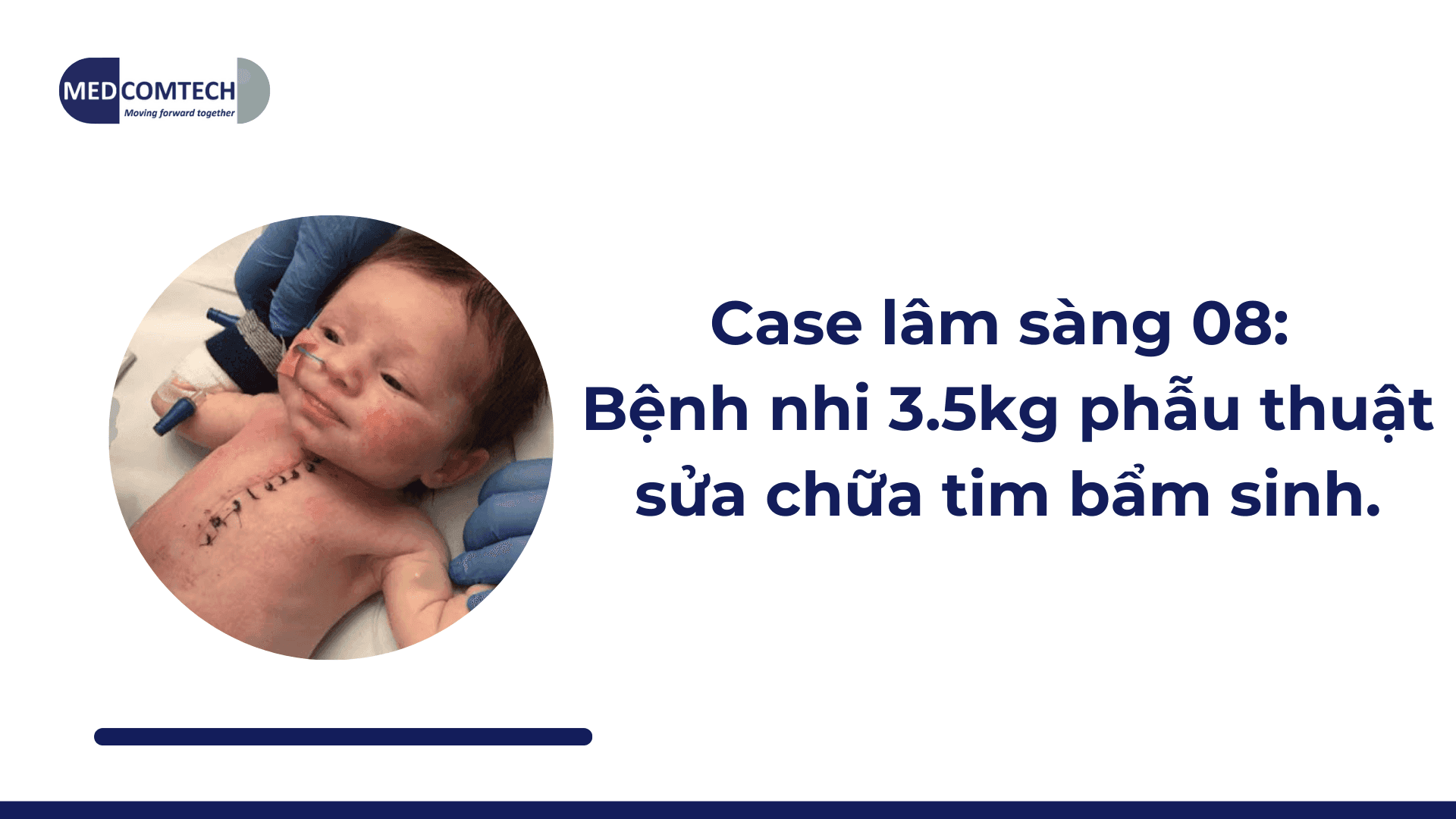 Case lâm sàng 08: Bệnh nhi 3.5kg phẫu thuật sửa chữa tim bẩm sinh.